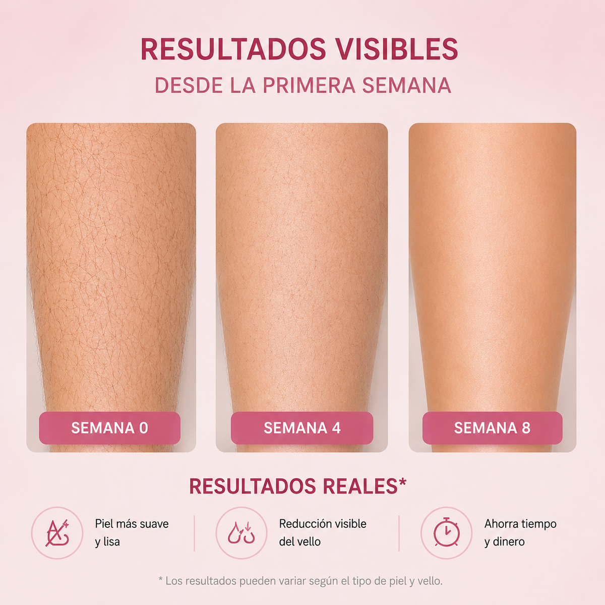 Ipluna Pro IPL — Depilación Láser Permanente en Casa