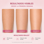Ipluna Pro IPL — Depilación Láser Permanente en Casa